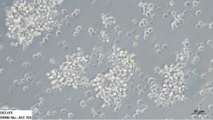 OCI-LY3 is a B-cell lymphoma cell line. Source: DSMZ