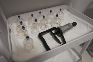 Patient receiving specialized cupping therapy and Registered Massage Therapy for back pain relief at North York clinic.