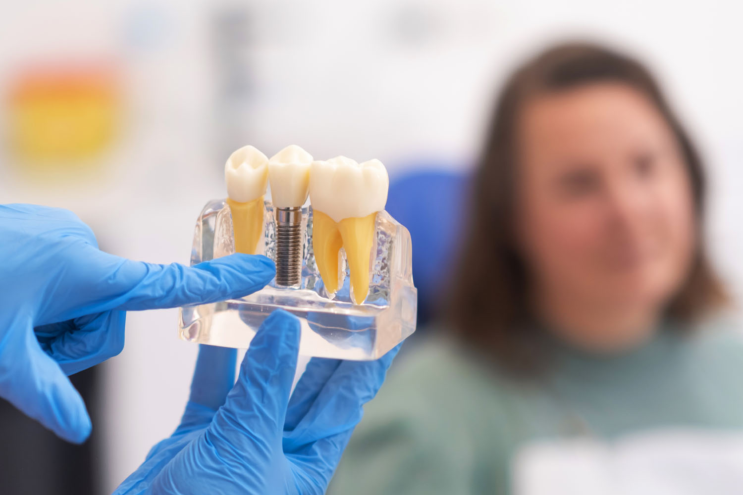 Dental Implants-galway-dentists-H91ERP4-69