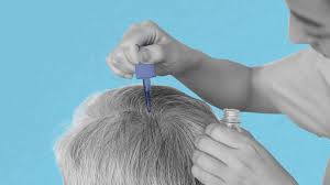 Hair Loss Prevention Product Market size