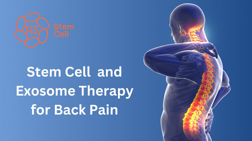stem cells back pain Mexico
